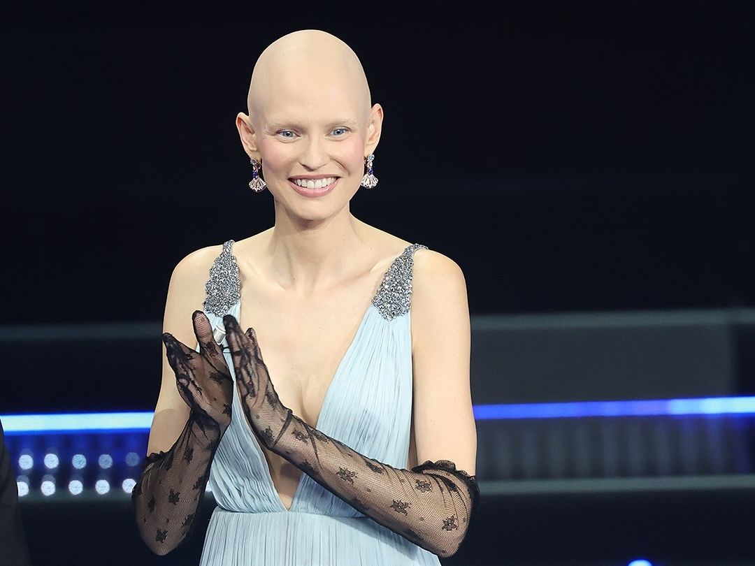 Η Bianca Balti χωρίς περούκα αποθεώνεται στη σκηνή του Sanremo: «Προτιμώ να γιορτάζω τη ζωή»
