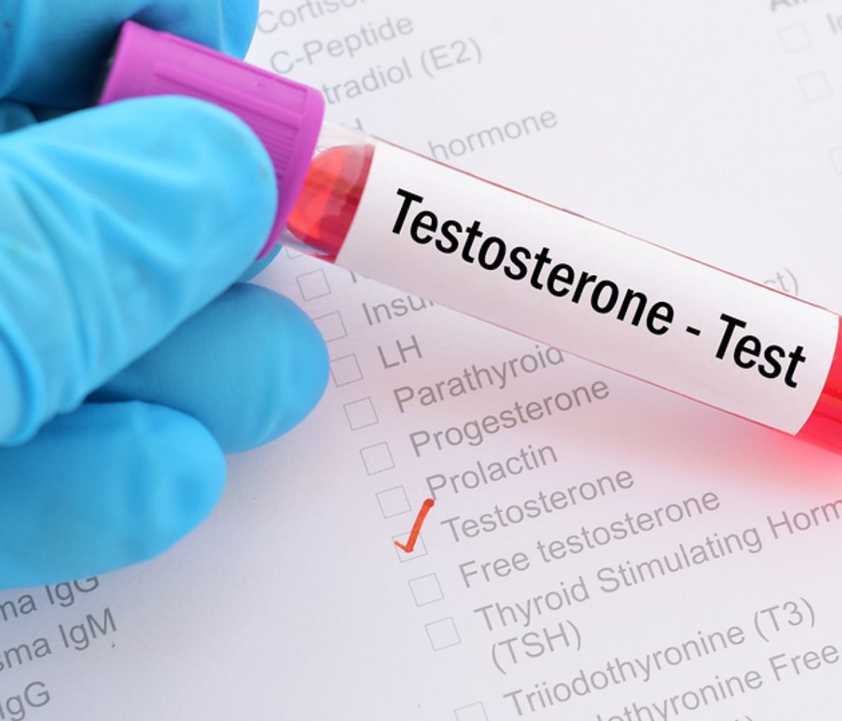 Τεστοστερόνη: Ποια είναι τα φυσιολογικά επίπεδα σε άντρες και γυναίκες