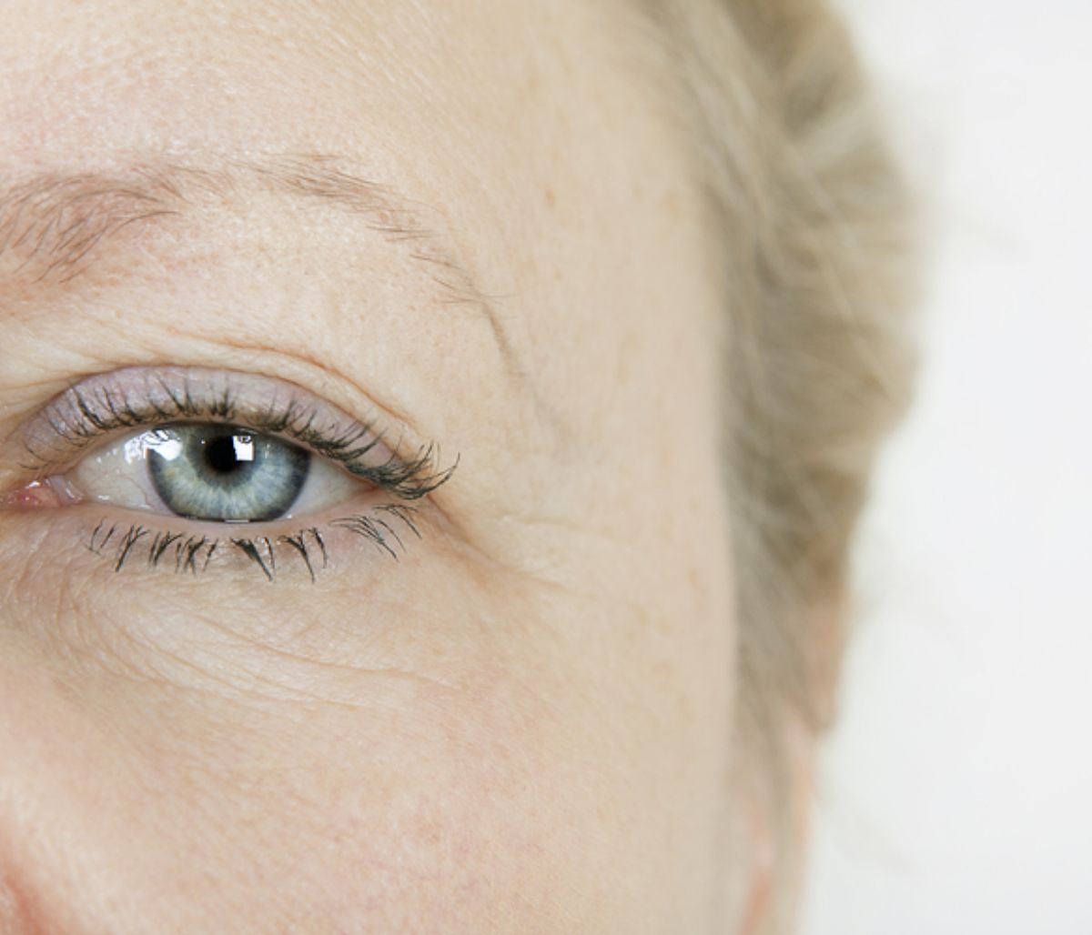 Bλεφαρόπτωση: Τι την προκαλεί και πώς αντιμετωπίζεται
