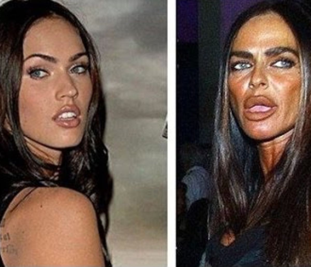 Δεκαεπτά celebrities πριν και μετά τις πλαστικές - Δείτε ποιες είναι οι πιο αποτυχημένες (vid)