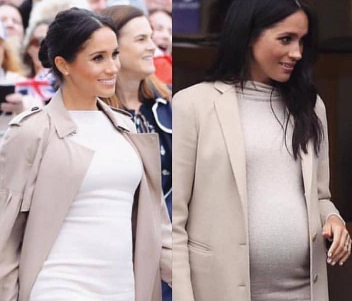 Έκανε πλαστικές για να μοιάσει στη Meghan Markle και τώρα τα παιδιά της δεν την αναγνωρίζουν (vid)