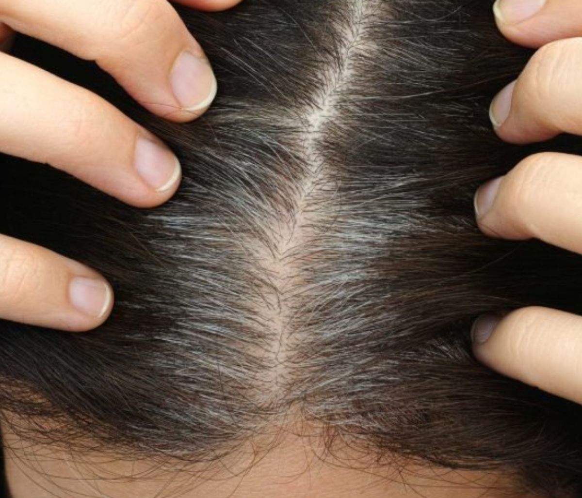 Πρόωρο γκριζάρισμα μαλλιών: 7 πιθανές αιτίες (pics)