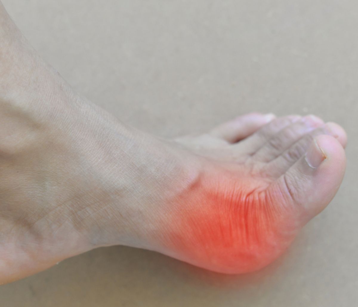 Ανεβασμένο ουρικό οξύ: Δείτε πώς θα το μειώσετε (εικόνες)