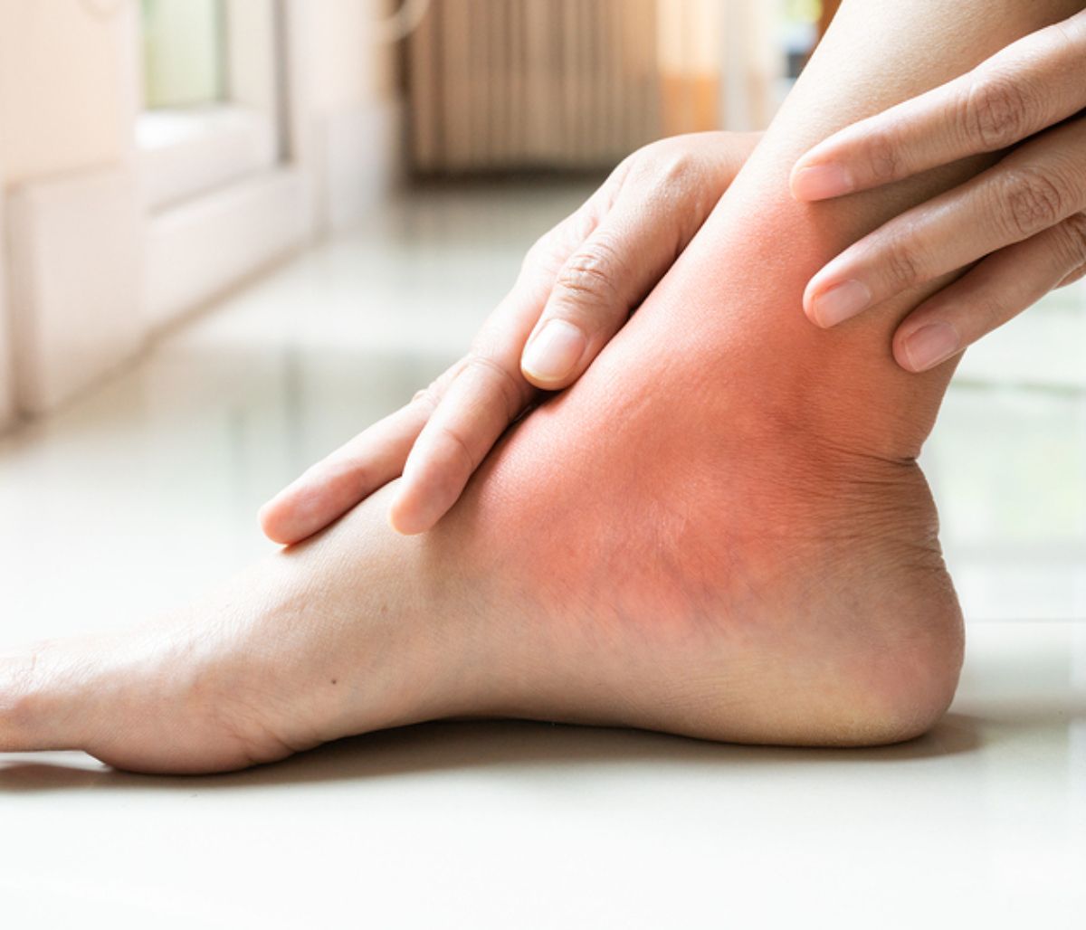 Πρησμένοι αστράγαλοι: 9 πιθανές αιτίες (εικόνες)