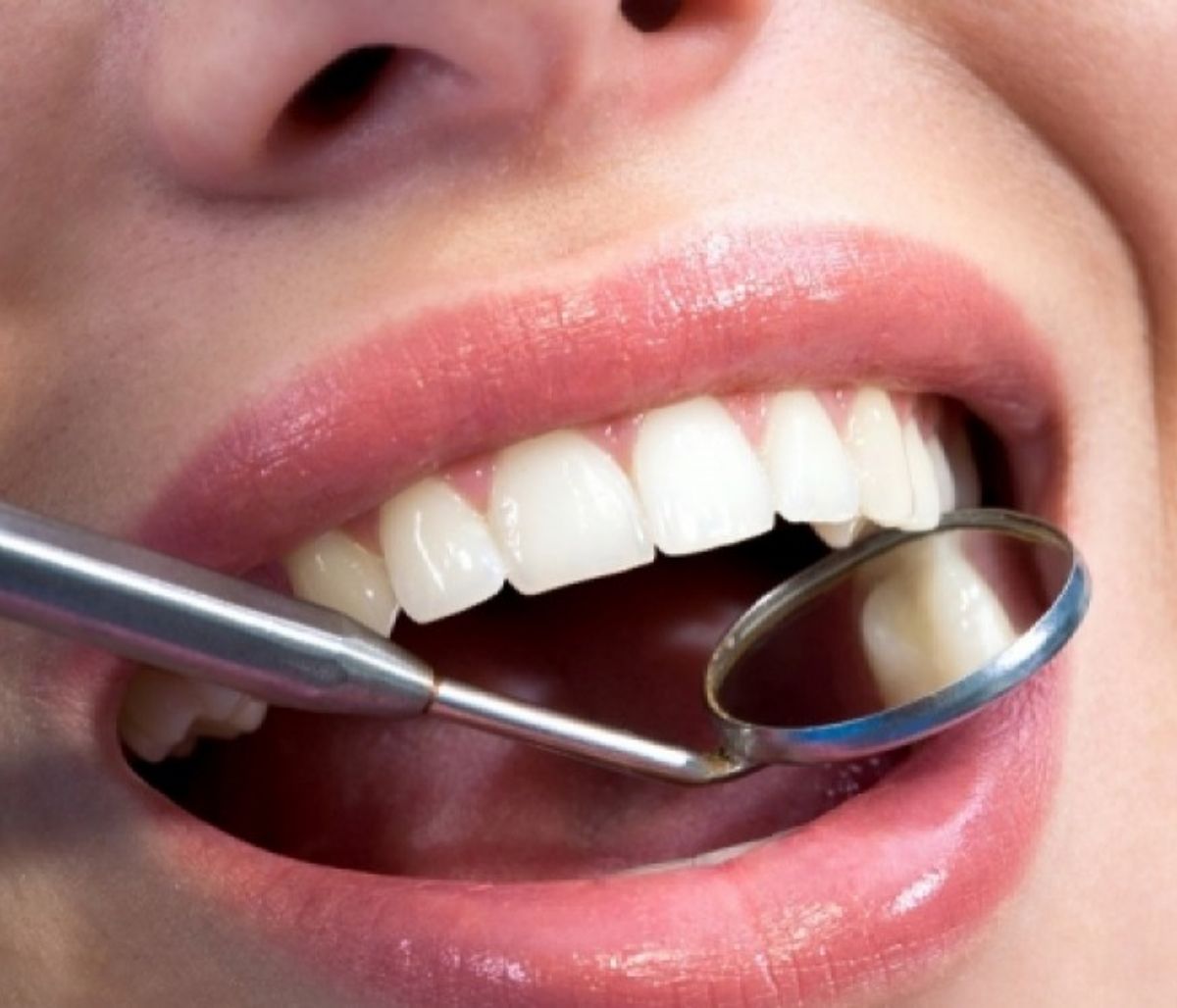 Τι σημαίνει η εικόνα των δοντιών για την υγεία σας (pics)