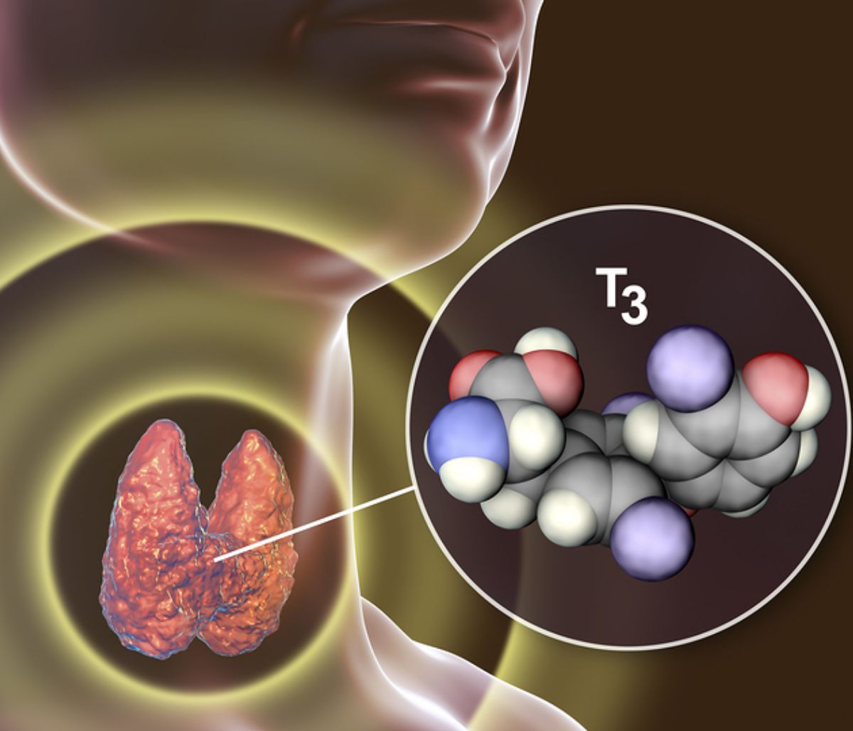 Θυρεοειδίτιδα Χασιμότο: Με ποια συμπτώματα εκδηλώνεται (εικόνες)