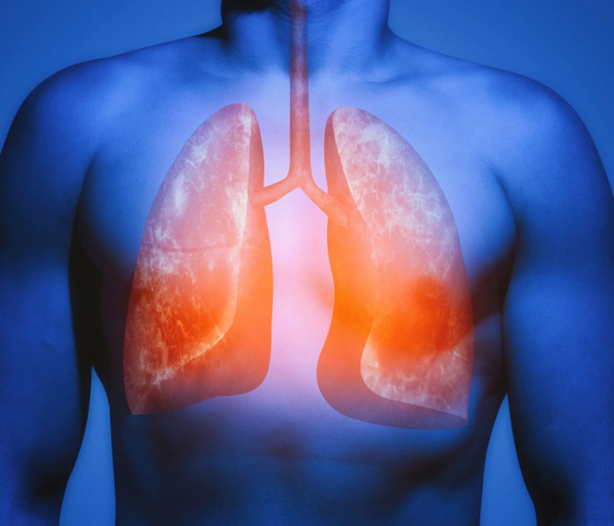 Οι τροφές που «καθαρίζουν» τους πνεύμονες (εικόνες)