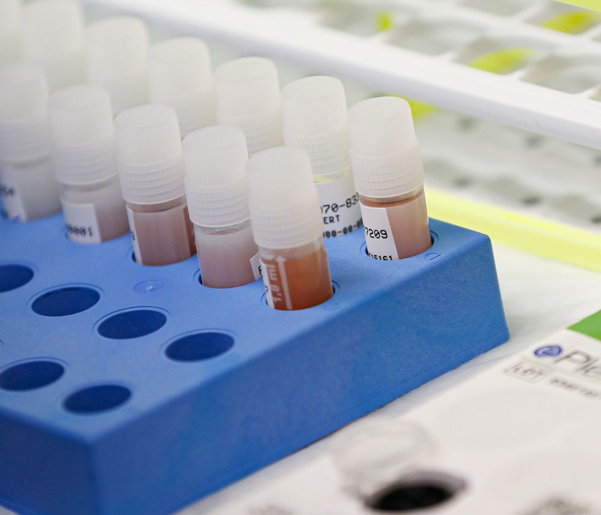 Κορονοϊός: Ενθαρρυντικά μηνύματα για το φάρμακο  - Αγώνας δρόμου από τους επιστήμονες