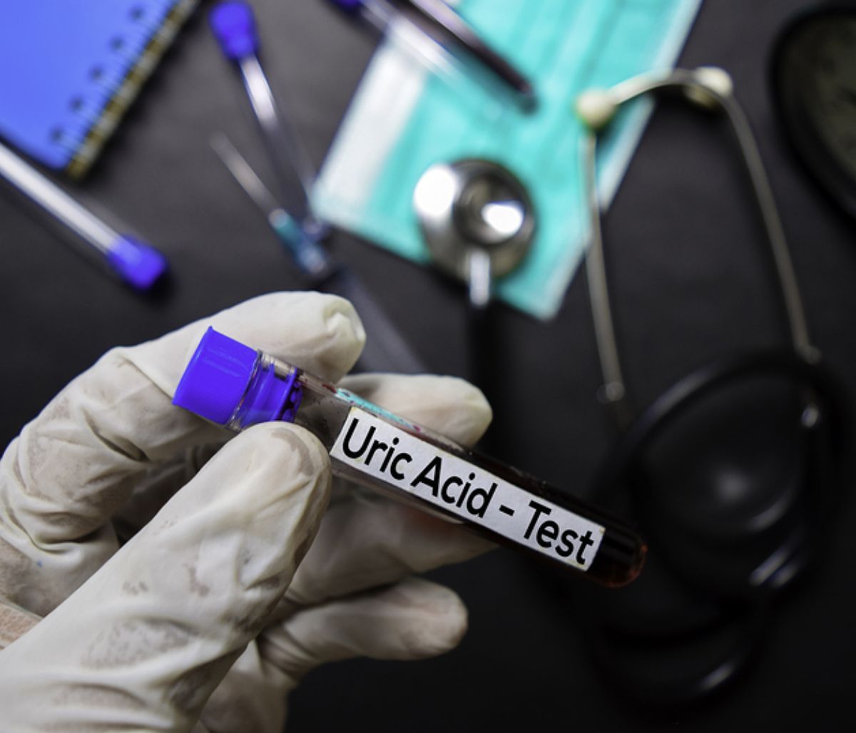 Ουρικό οξύ: 10 τροφές που πρέπει να αποφεύγετε (βίντεο)