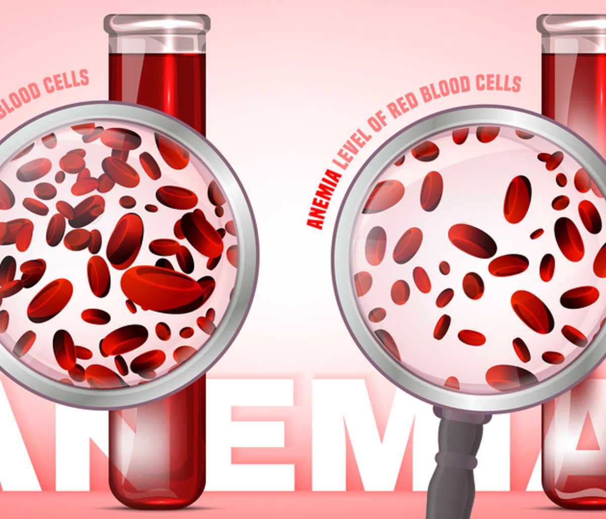 Έλλειψη σιδήρου: Τα σημάδια που τη μαρτυρούν μέσα από βίντεο