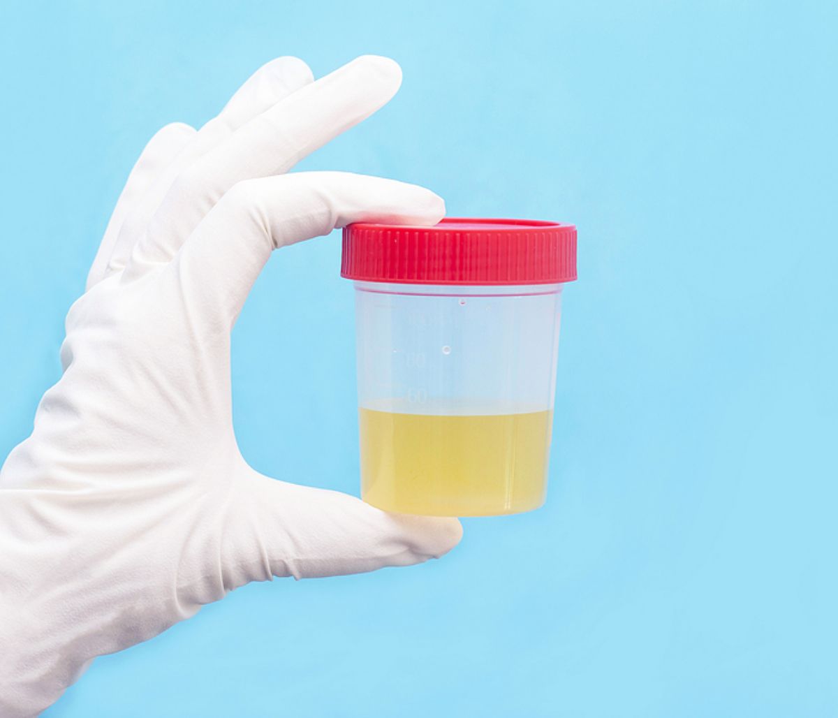 Ούρα: 5 πράγματα που φανερώνουν για την υγεία (εικόνες)