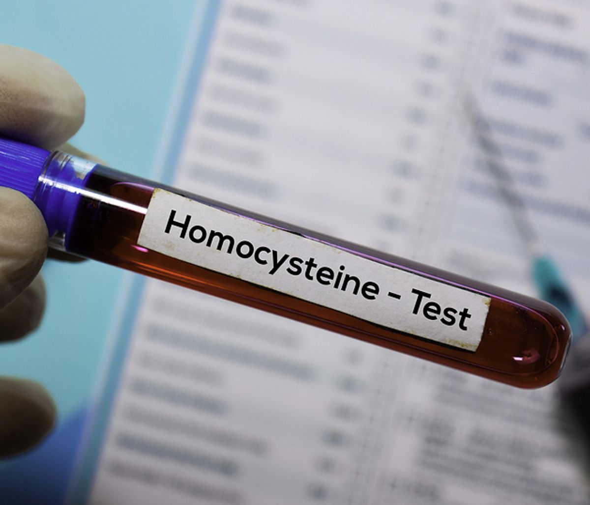 Ομοκυστεΐνη: Με ποιες παθήσεις συνδέεται και τι προκαλεί την αύξησή της (εικόνες)