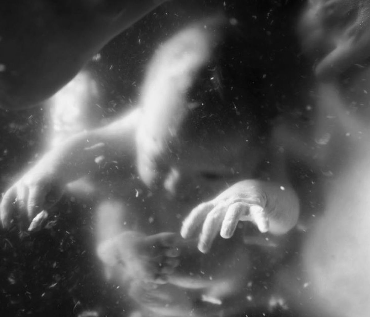 Μωράκι γεννήθηκε με ορθάνοιχτα ματάκια