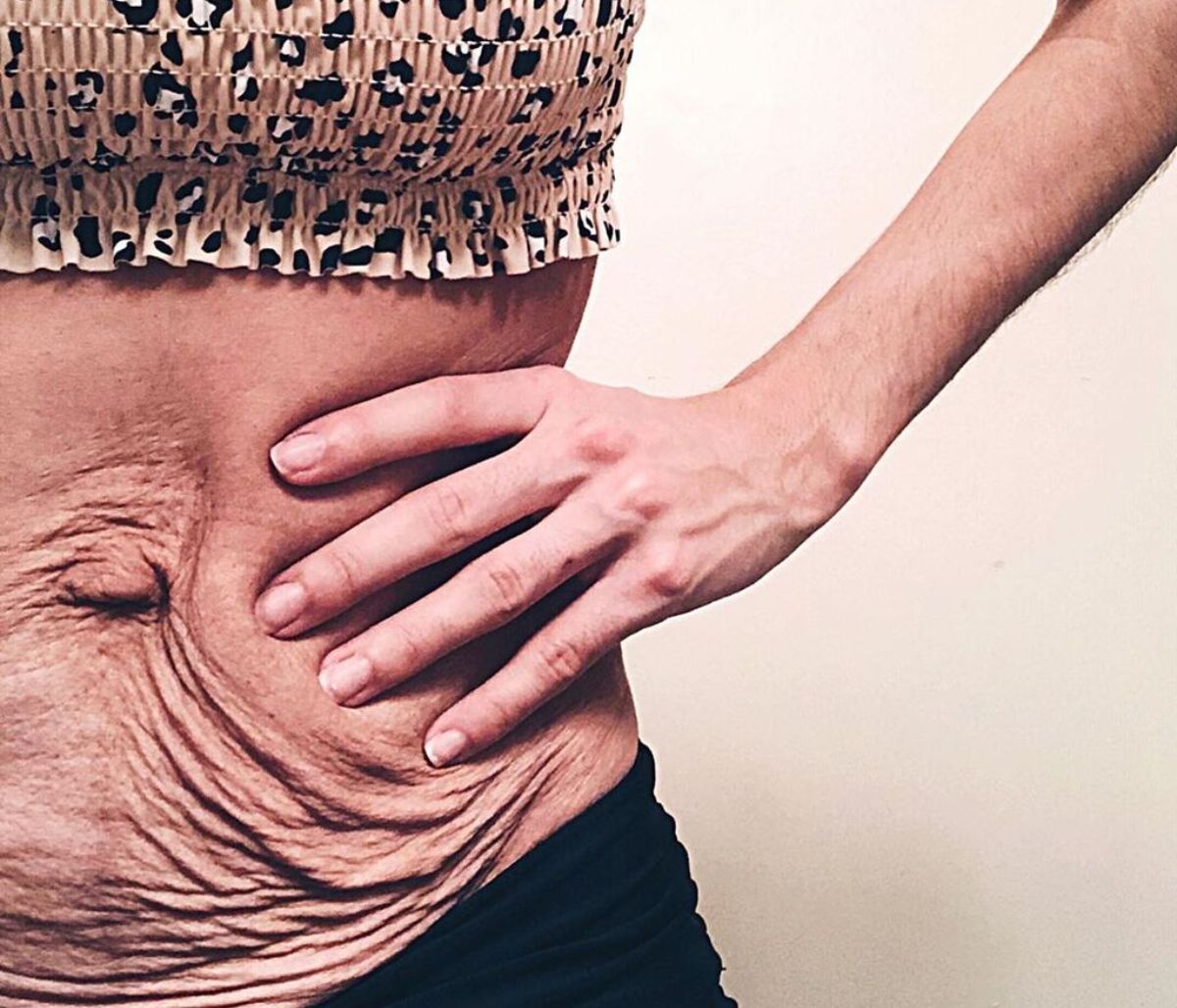 Body shaming: Δείχνει την κοιλιά της και στέλνει ένα δυνατό μήνυμα