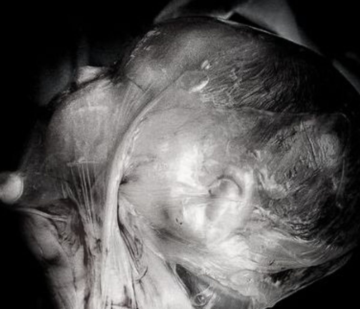 En Caul: Ένα σπάνιο φαινόμενο μέσα από φωτογραφίες