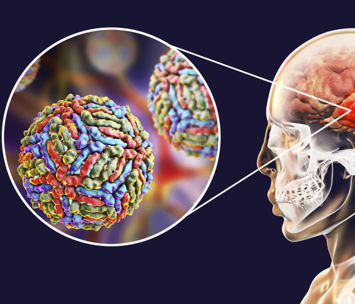 Εγκεφαλίτιδα: 6 ενδείξεις σε εικόνες