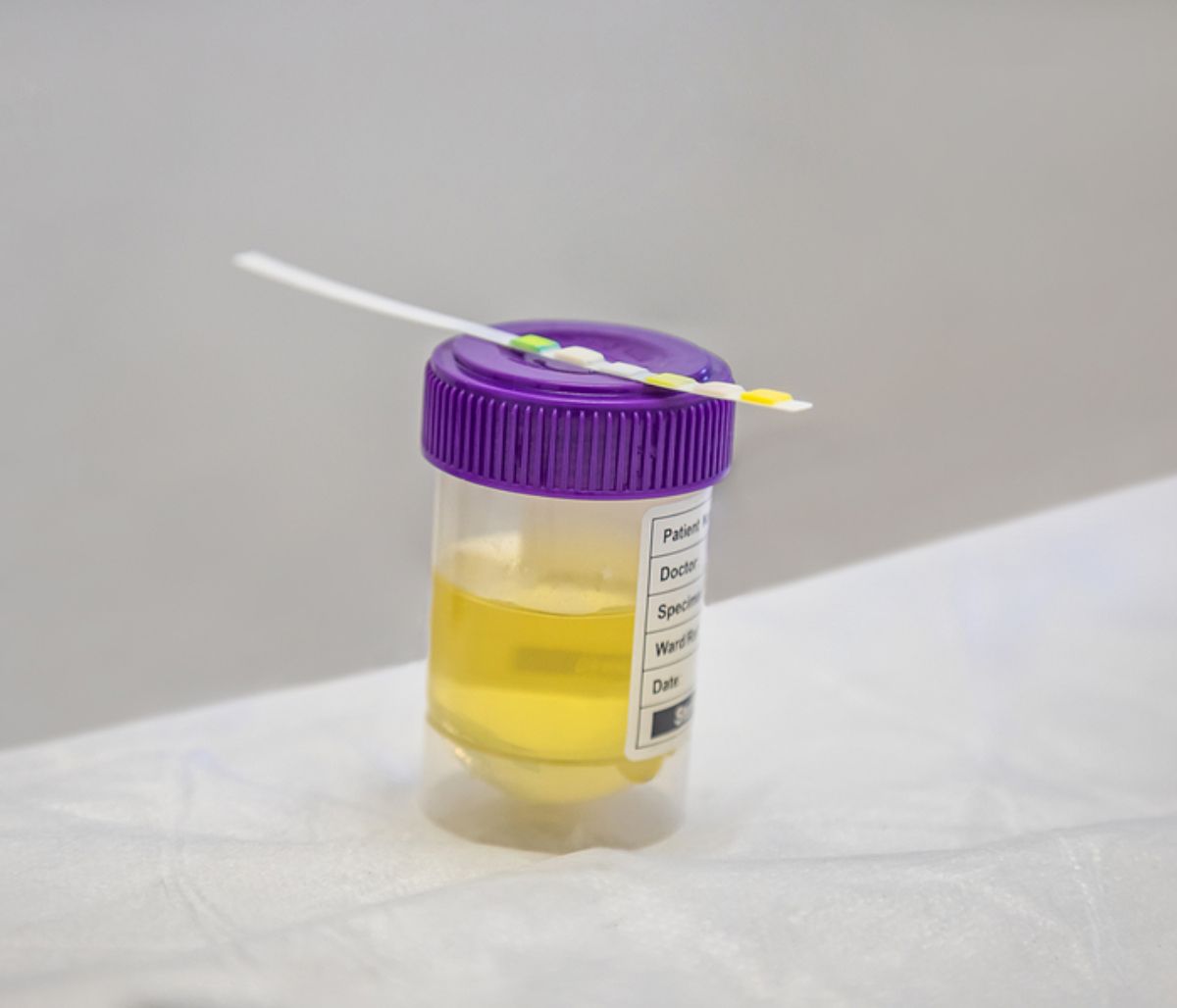 Ούρα: Ποια προβλήματα υγείας επηρεάζουν το χρώμα τους (εικόνες)