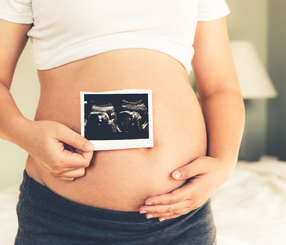 Αιμορροΐδες στην εγκυμοσύνη: Τι πρέπει να γνωρίζετε