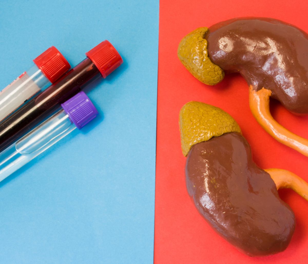 Αυξημένη κρεατινίνη: 6 τρόποι για να την μειώσετε (εικόνες)