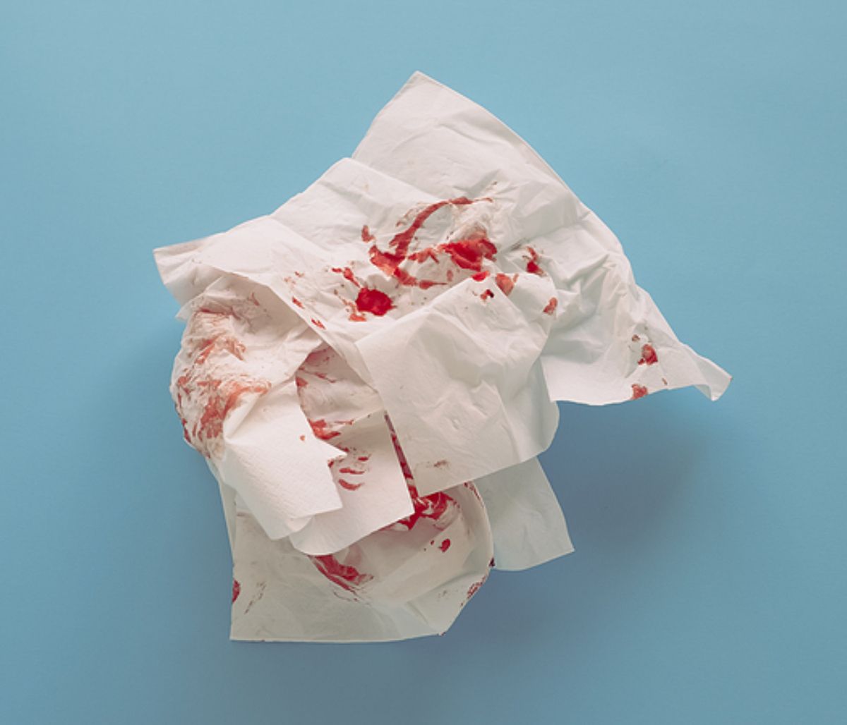 Αίμα από τη μύτη: Για ποιες παθήσεις προειδοποιεί (εικόνες)