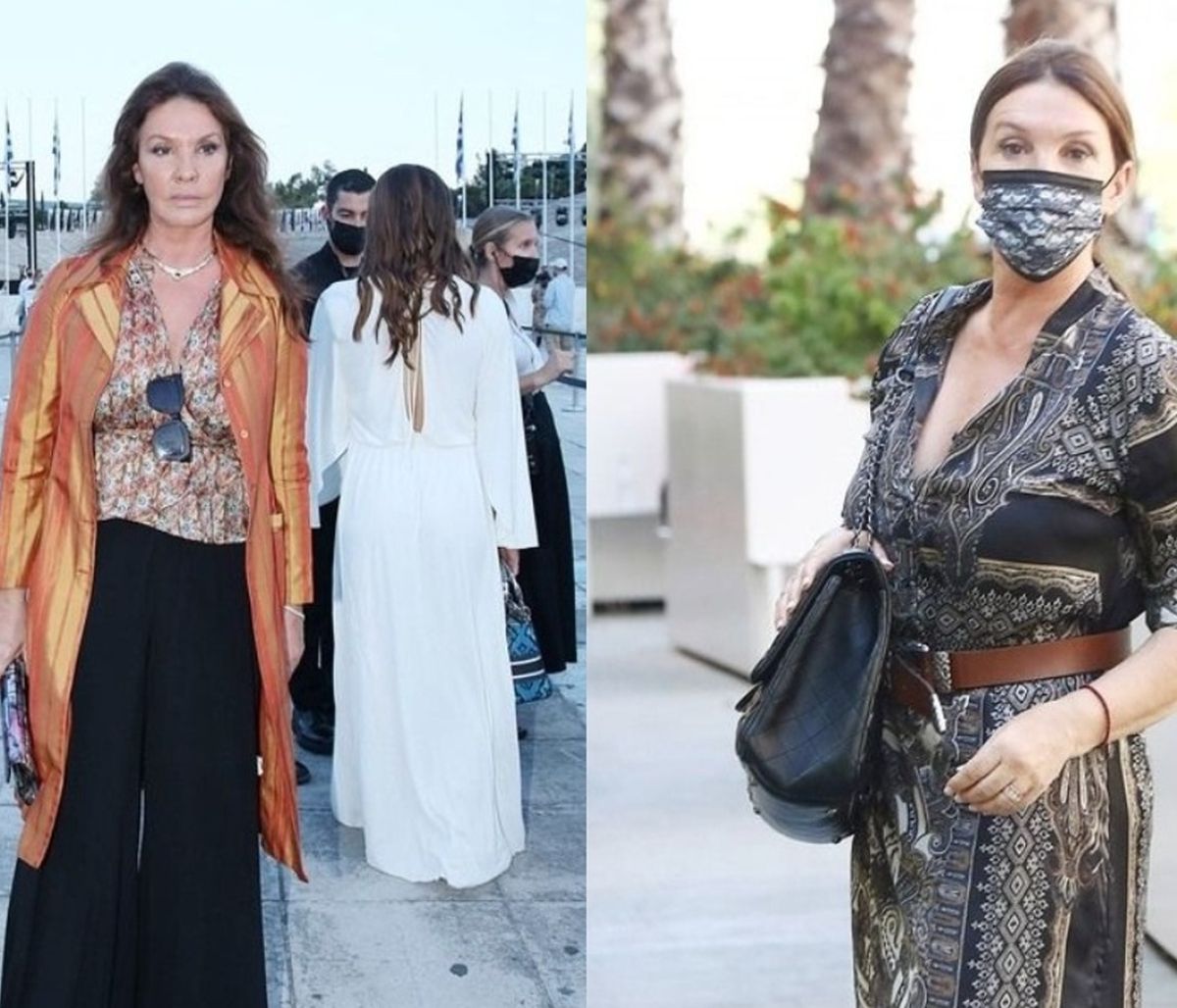 Η Βάνα Μπάρμπα στο gossip-tv μέσα από το νοσοκομείο: «Έσπασα το μετατάρσιο και θα χειρουργηθώ»