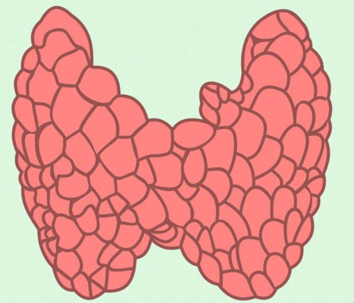 Θυρεοειδίτιδα Hashimoto: Τα βασικά συμπτώματα σε εικόνες