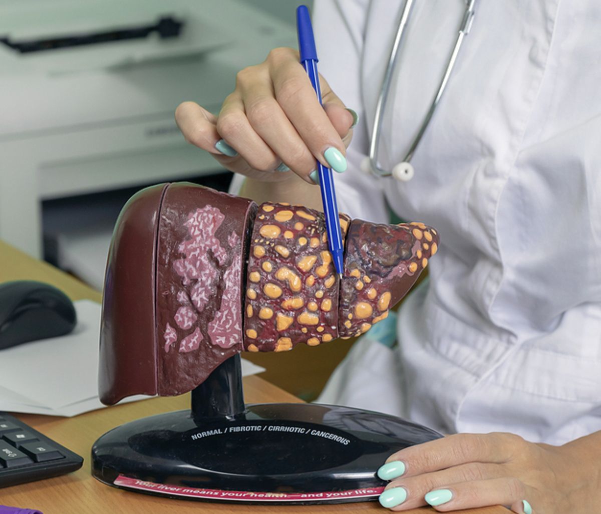 14 ενδείξεις ότι το συκώτι σας υποφέρει (video)