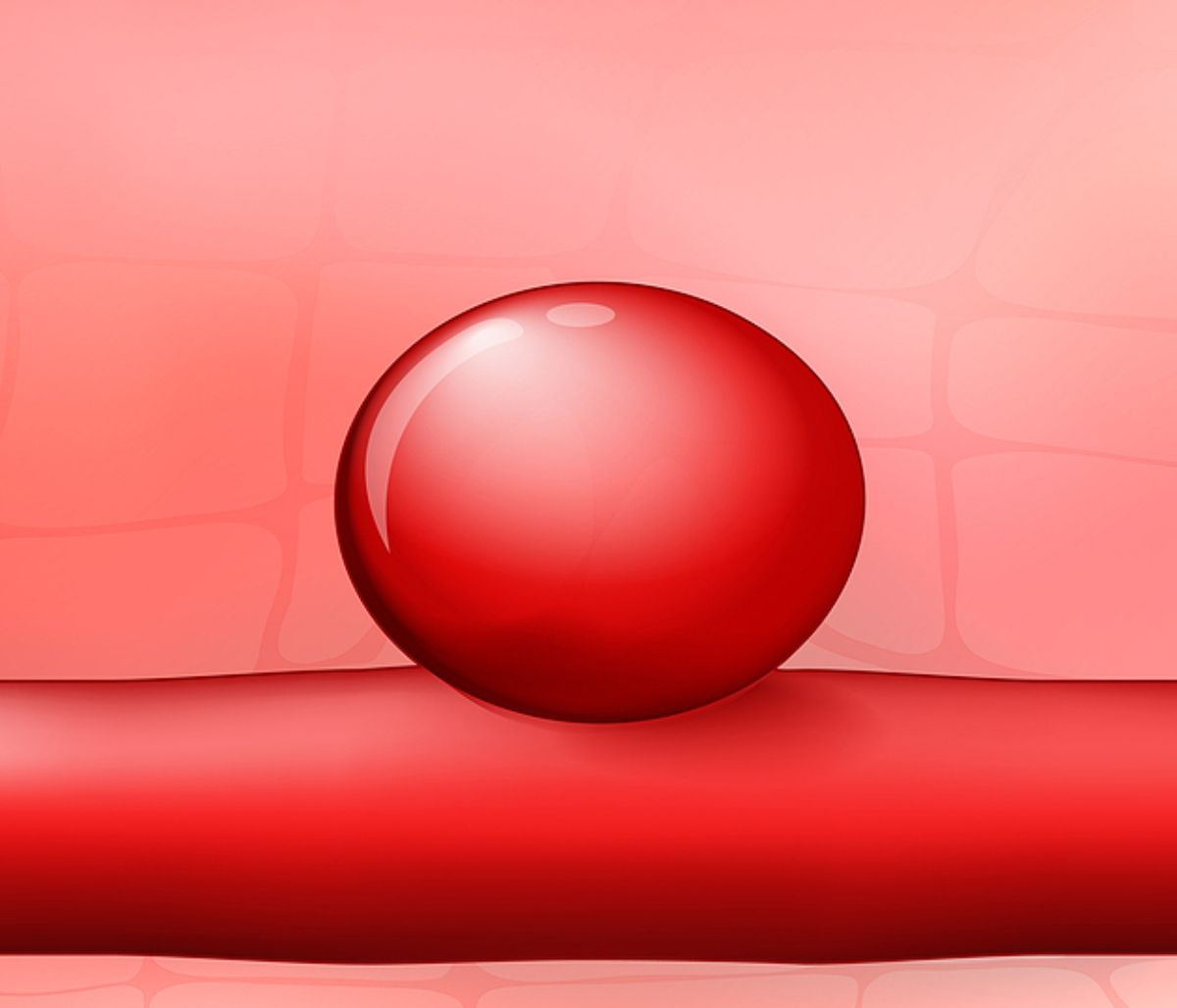 Ανεύρυσμα αορτής: Πού μπορεί να οφείλεται (εικόνες)