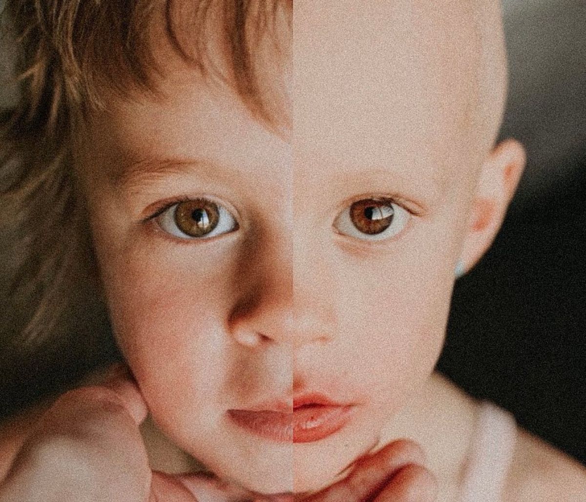 Μαμά κατέγραψε τη μάχη της κόρης της με τον παιδικό καρκίνο - Η ιστορία μίας μικρής νικήτριας