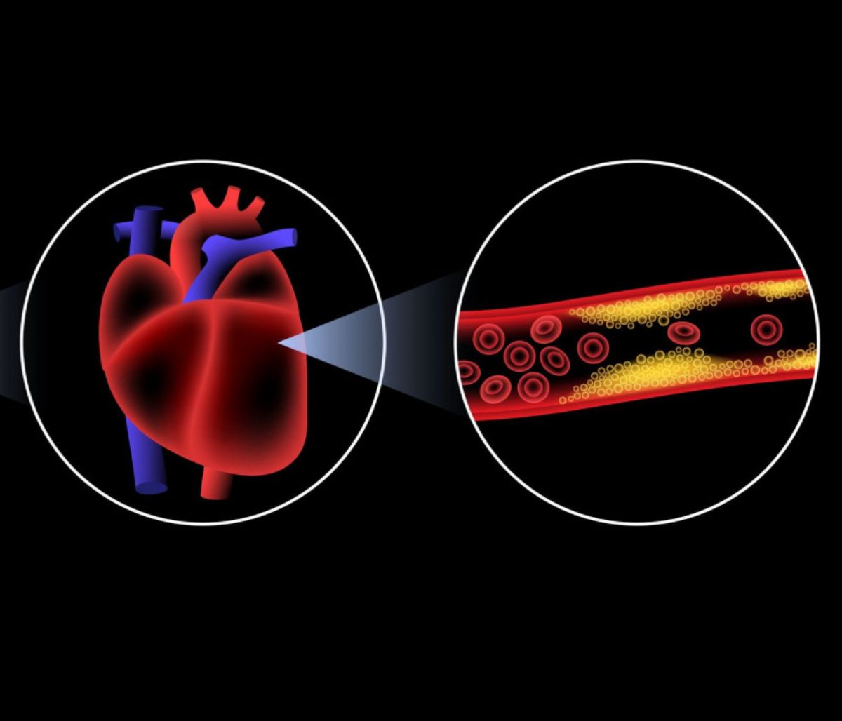 Πρόβλημα στις αρτηρίες: Προσοχή σε αυτά τα παράδοξα σημάδια (εικόνες)