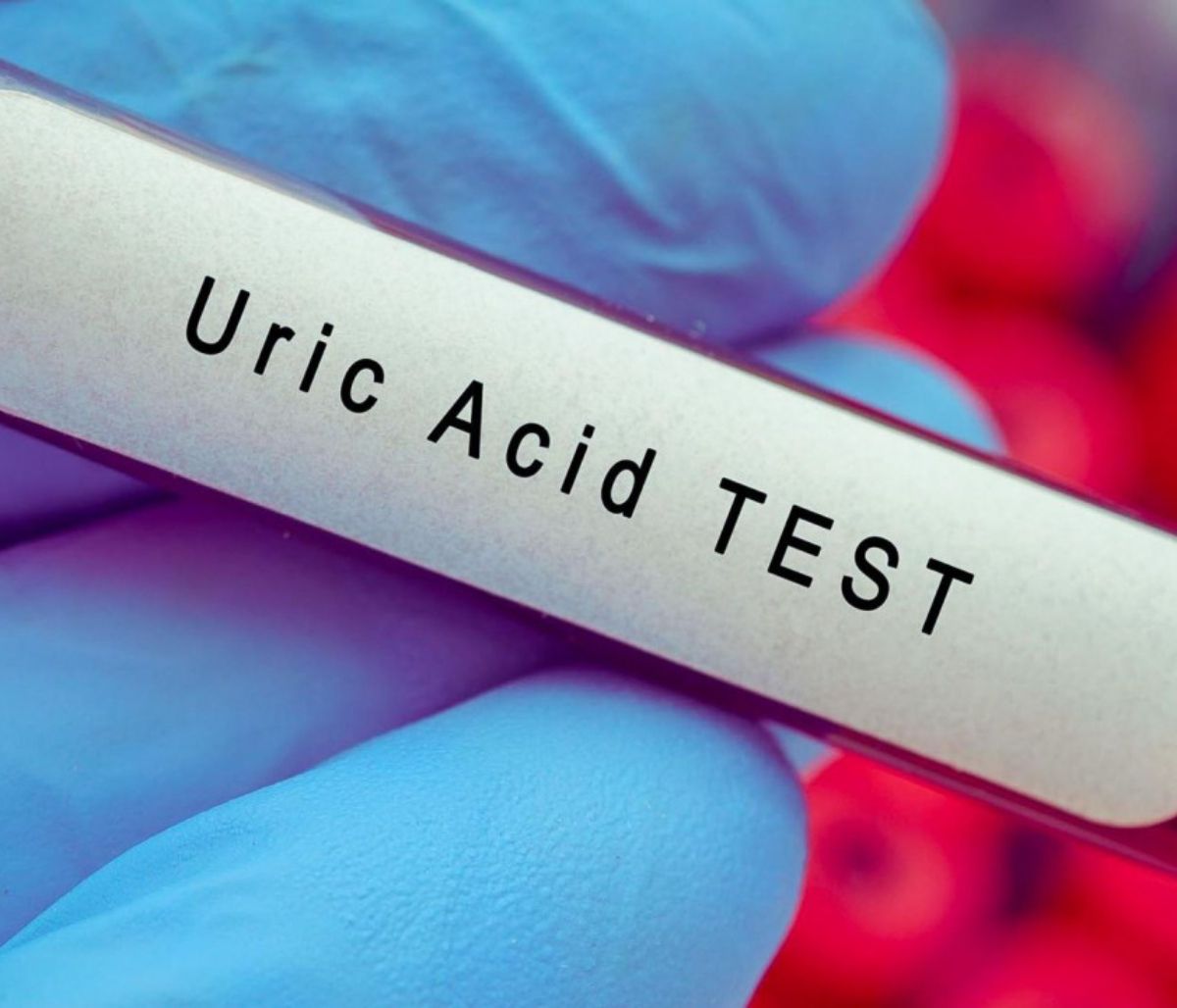 Υψηλό ουρικό οξύ: Τέσσερις διατροφικοί κανόνες για να το μειώσετε (εικόνες)