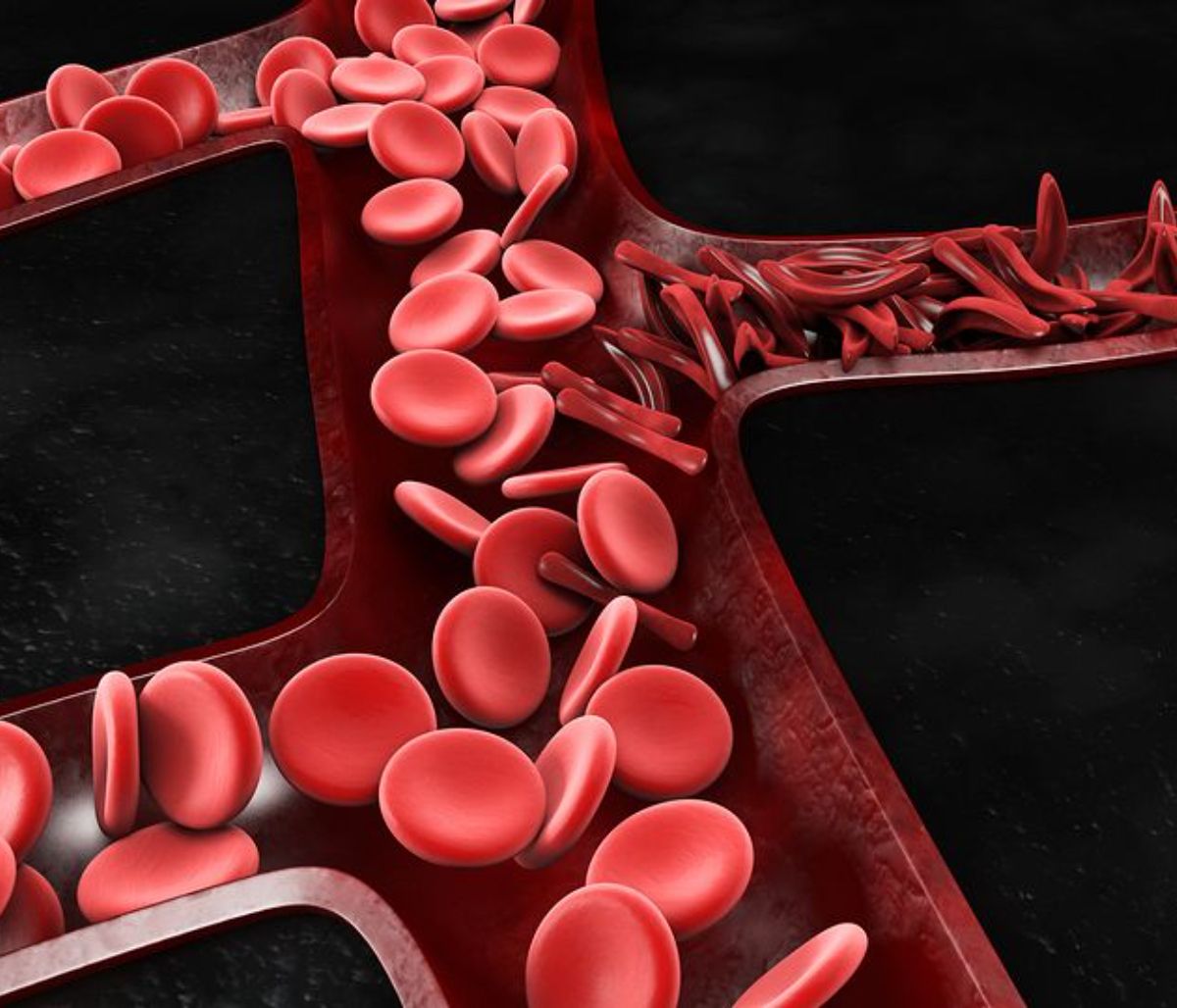 Προβληματική κυκλοφορία αίματος: Τα ορατά σημάδια που δεν πρέπει να αμελήσετε (εικόνες)