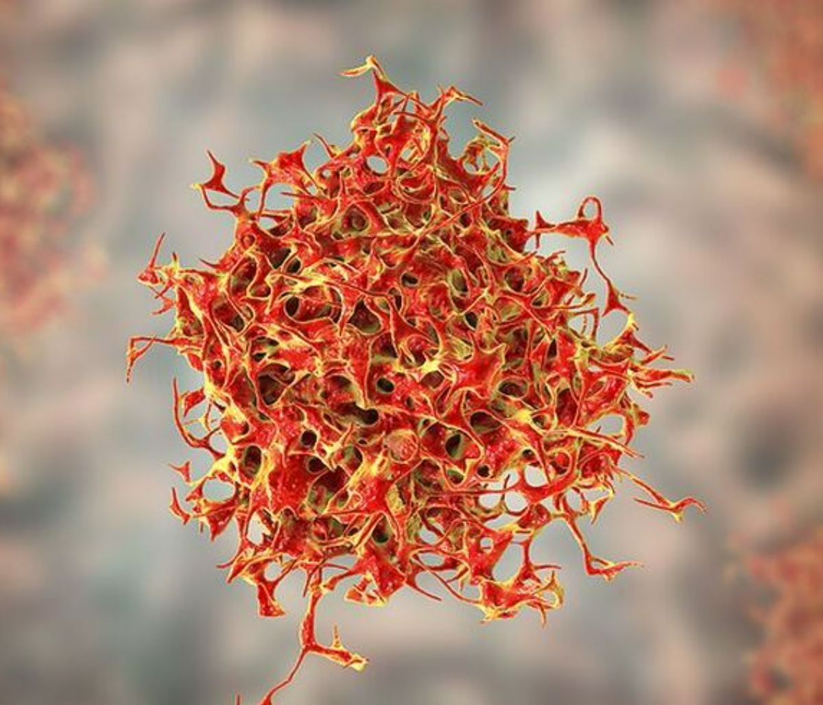 Νέα εξαιρετικά ελπιδοφόρα θεραπεία για τον καρκίνο σταματά την ανάπτυξη του ενός τρίτου των όγκων