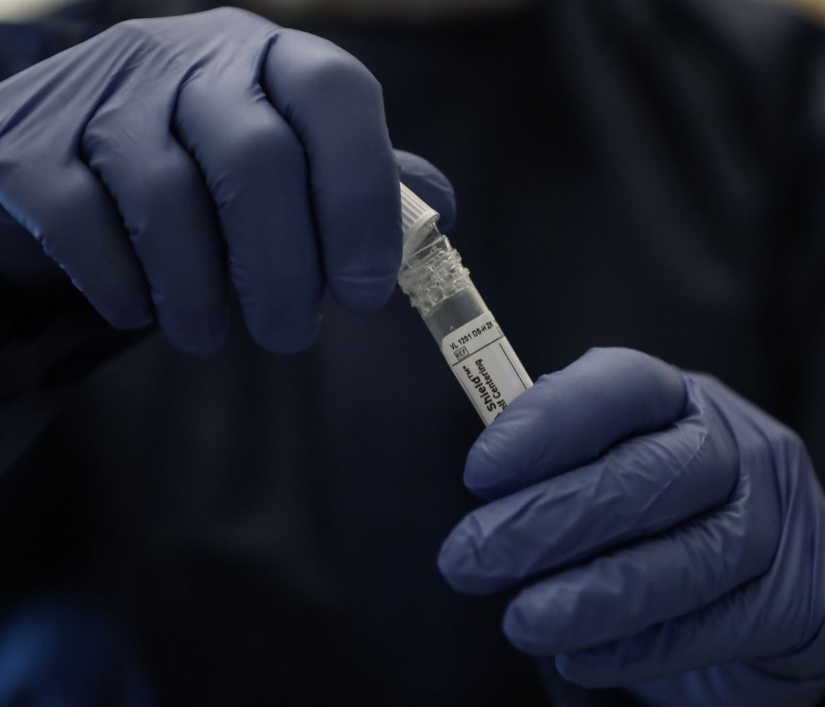 Μαγιορκίνης: Κατά 99% ο ιός της οξείας ηπατίτιδας βρίσκεται ήδη στην Ελλάδα