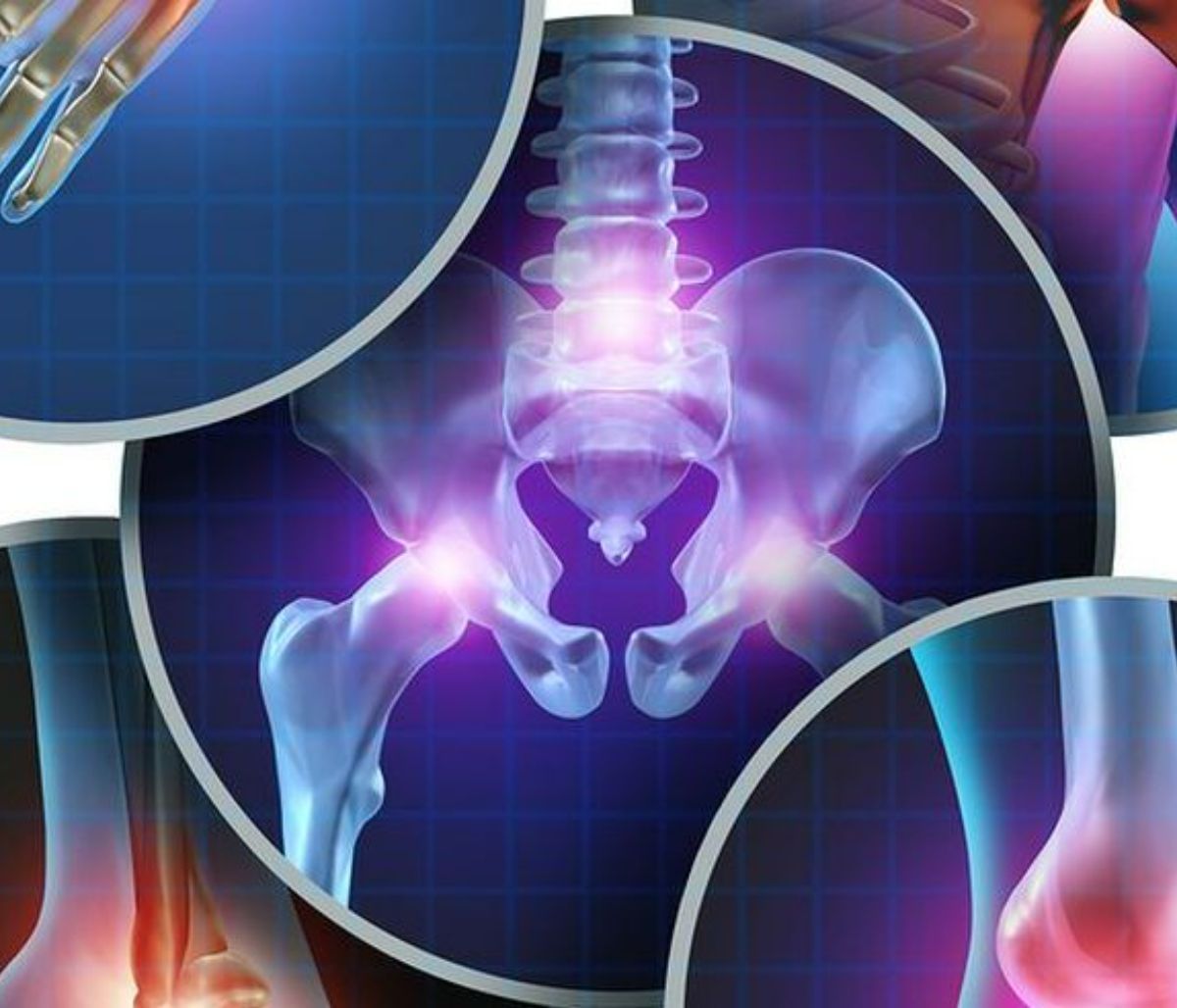 Αγκυλοποιητική σπονδυλίτιδα: Οι 4 παράγοντες κινδύνου για αυτόν τον τύπο νωτιαίας αρθρίτιδας