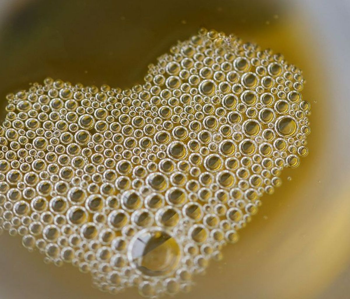 Αφρώδη ούρα: Οι παθολογικές αιτίες, τα συμπτώματα & οι λόγοι που θα σας οδηγήσουν στον γιατρό