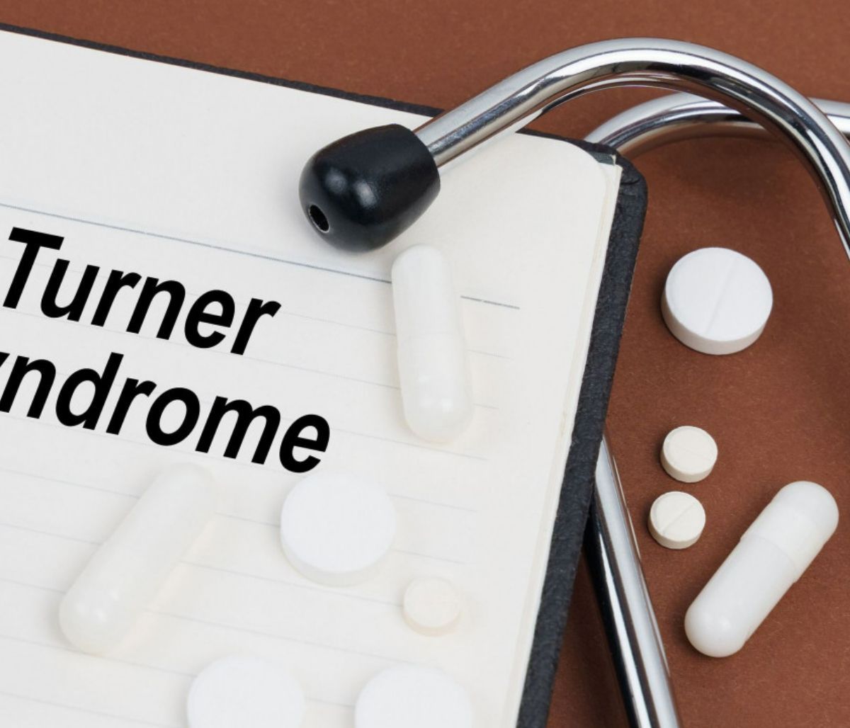 Σύνδρομο Turner: Η γενετική βάση, η διάγνωση και η αντιμετώπισή του