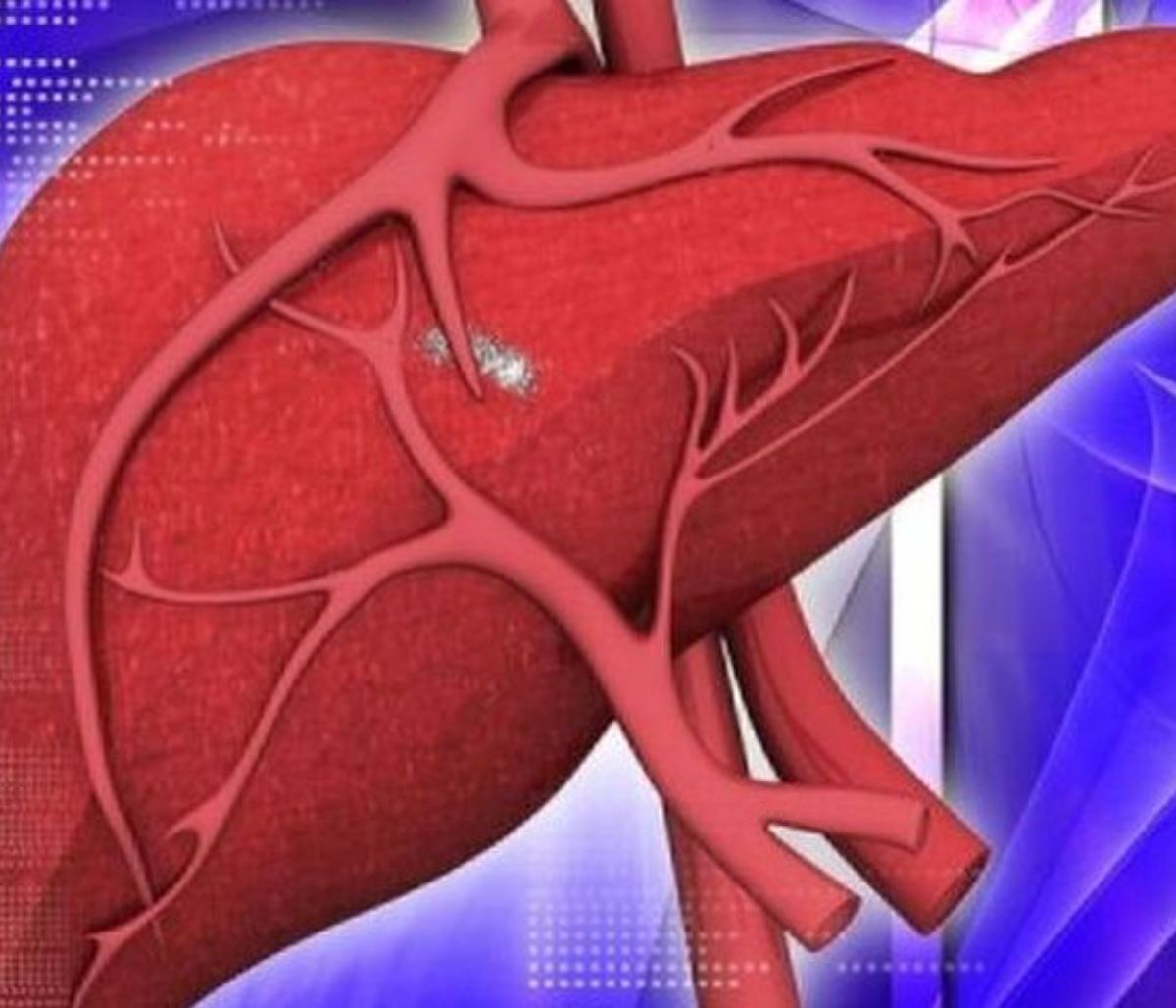 Οι 8 τροφές για υγιές συκώτι που δεν πρέπει να λείπουν από το διαιτολόγιό σας