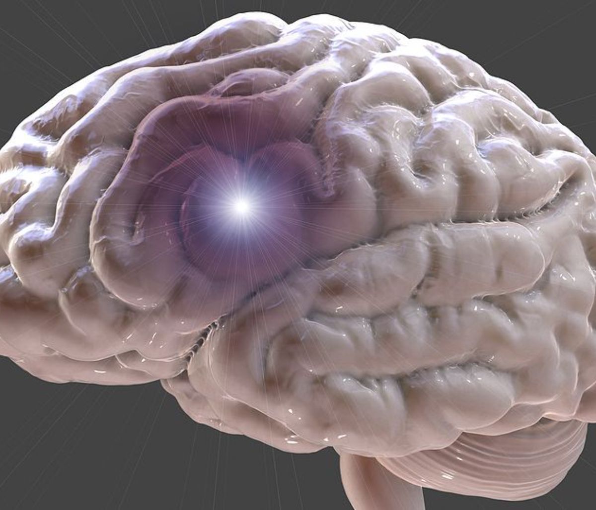 Ατμοσφαιρική ρύπανση: Πόσο αυξάνει τον κίνδυνο εγκεφαλικού