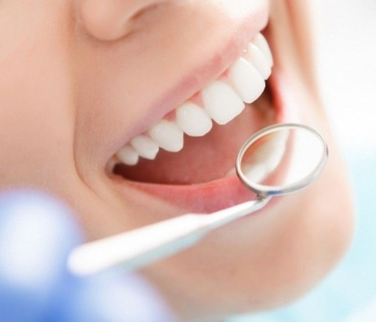 Περιοδοντίτιδα & έλκη στο στόμα: Πώς θα τα προλάβετε