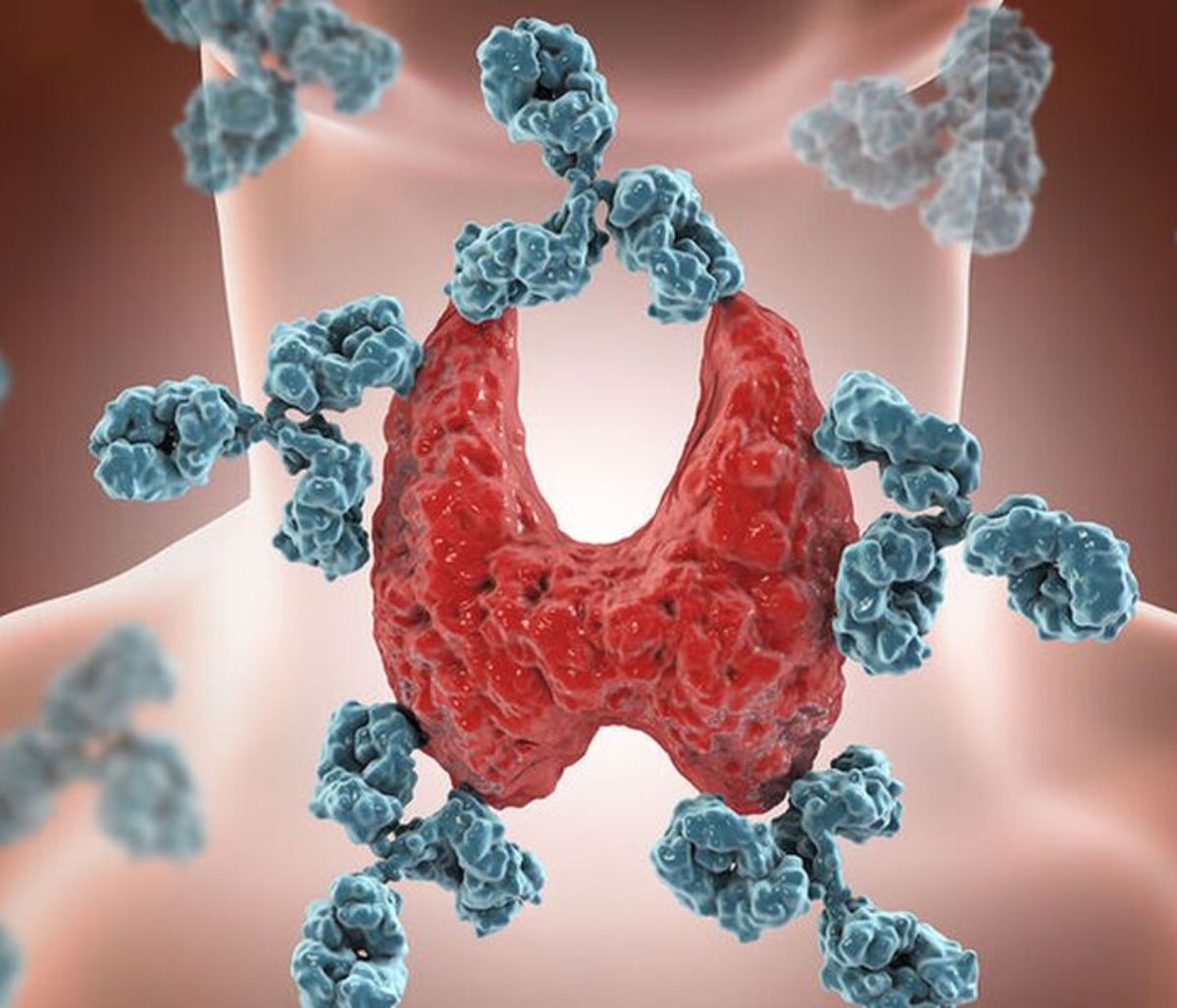 Καρκίνος θυρεοειδούς: Ο ρόλος της κεντρικής παχυσαρκίας