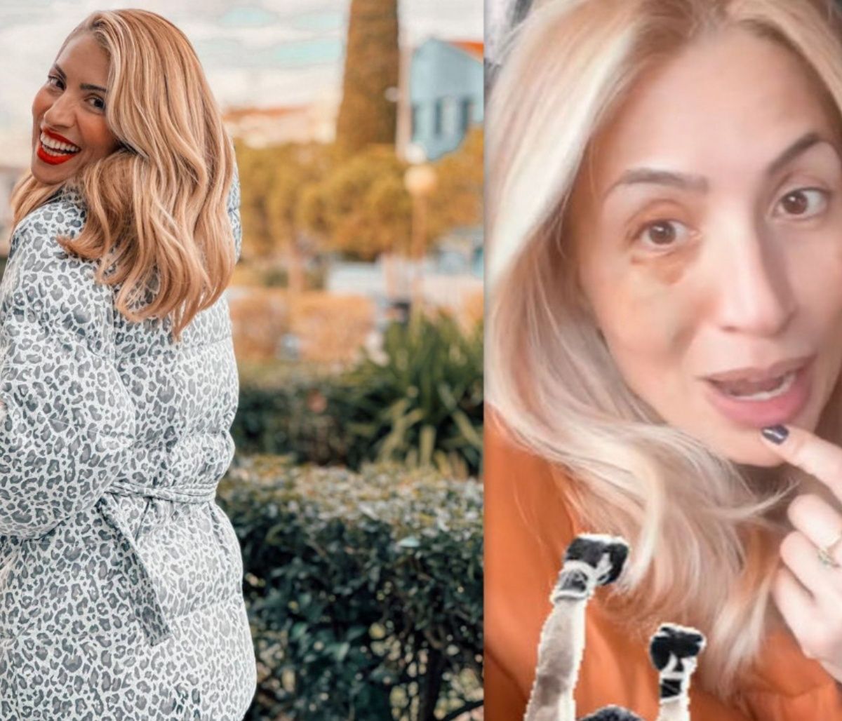 Ηλιάκη: Με μελανιασμένο μάτι από την κόρη της: «Μεγαλώνω τον Ρόκυ»