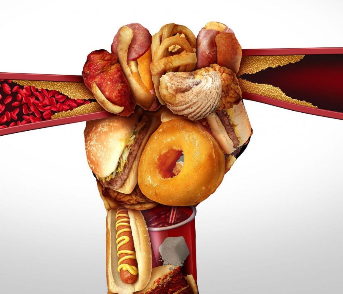 Τα γονίδια που ευθύνονται για τη στεφανιαία νόσο