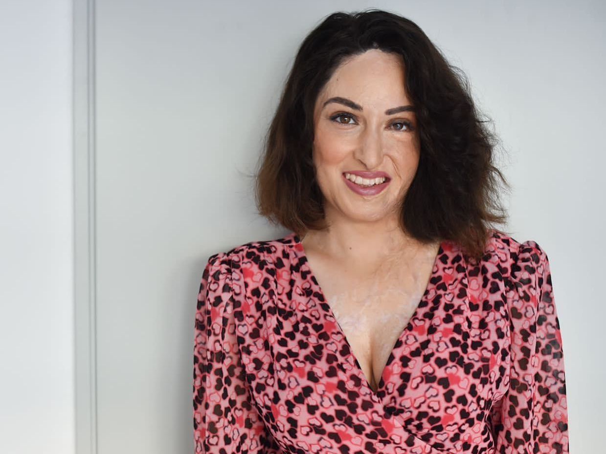 Ιωάννα Παλιοσπύρου: Μία μεγάλη «αγκαλιά» ο κόσμος για τη νέα φωτογραφία χωρίς μάσκα