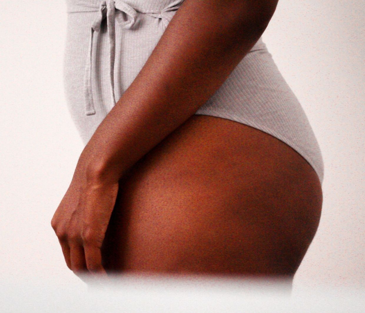 Προσέχουμε για να έχουμε! Ξεκίνα να βάζεις κρέμα για κυτταρίτιδα από τώρα