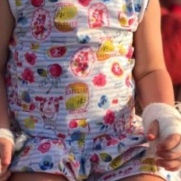 Tι έπαθε η μικρή στα χέρια της; Κατακραυγή στη διάσημη μαμά!