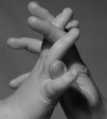 Αυτισμός και παιδί