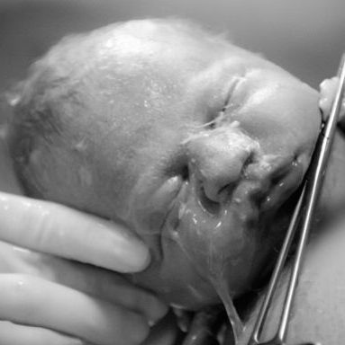 Μοναδικές φωτογραφίες τοκετού. Οι φατσούλες των μωρών όταν γεννιούνται