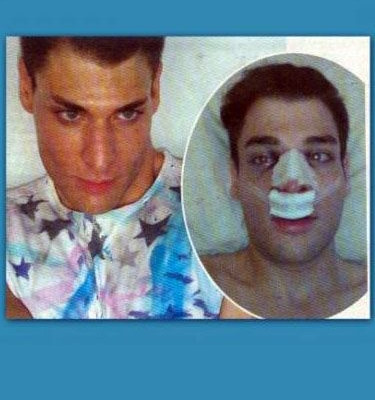 Στο νοσοκομείο μοντέλο λίγο πριν τα καλλιστεία!