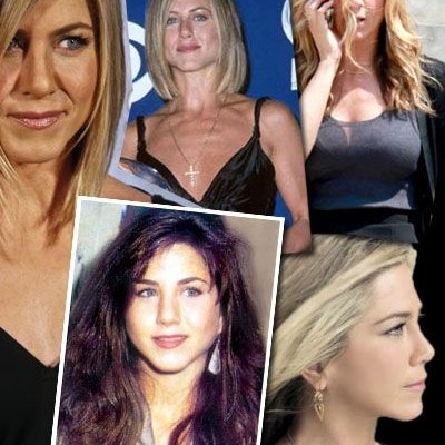 Πόσες πλαστικές έχει κάνει η Jennifer Aniston;